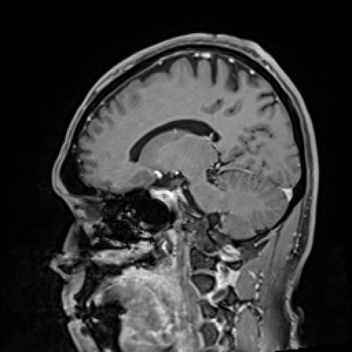 Click on the Serie image to view the images of VILLANUEVA, WILLIAM A.